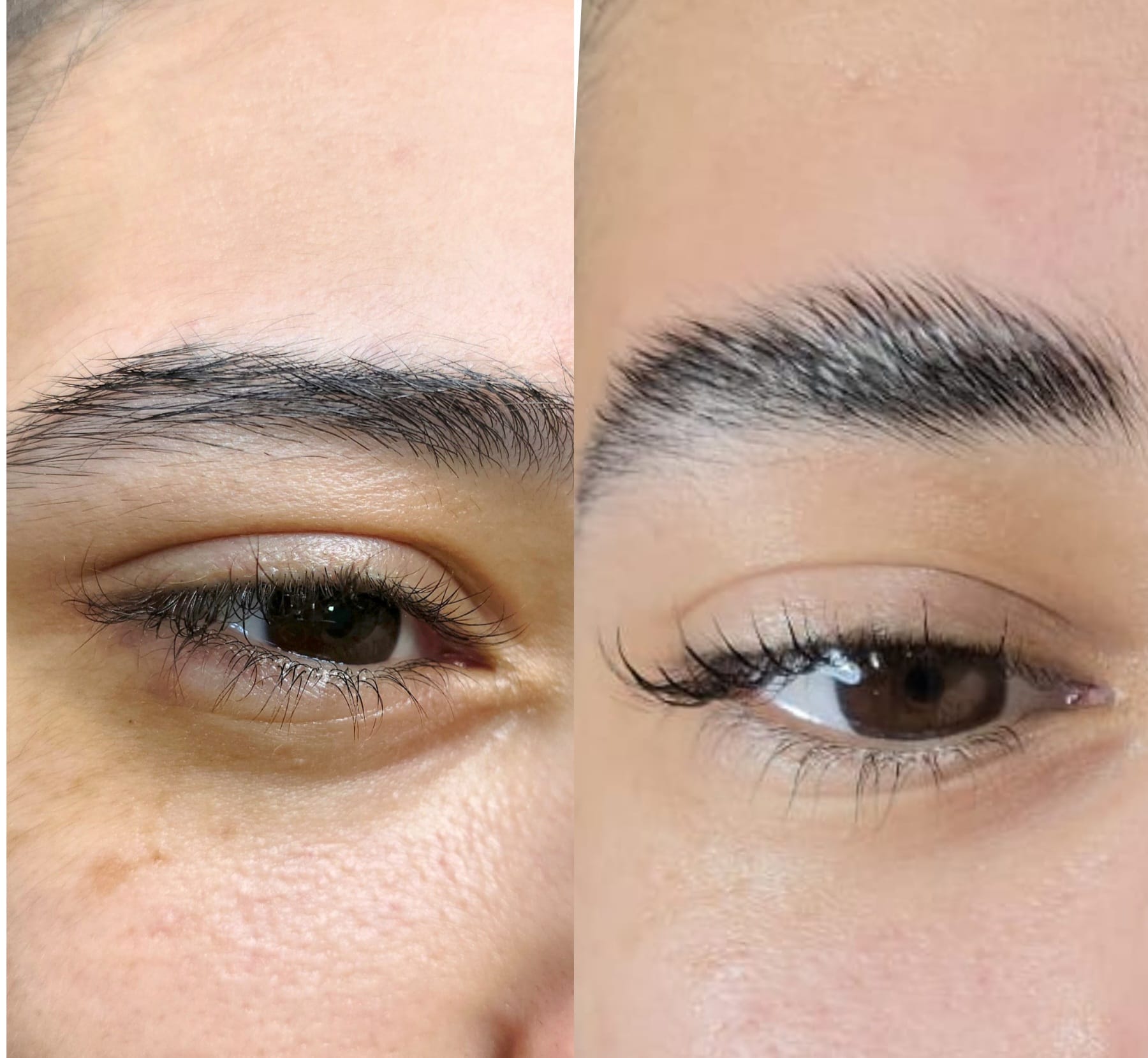 לפני ואחרי - שיקום גבות